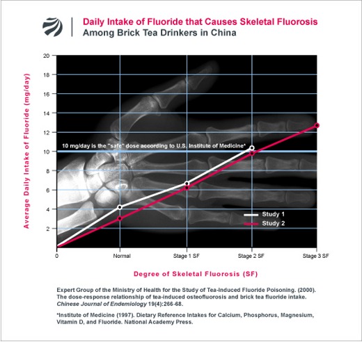 Daily Intake of Fluoride that Causes Skeletal Fluor0sis