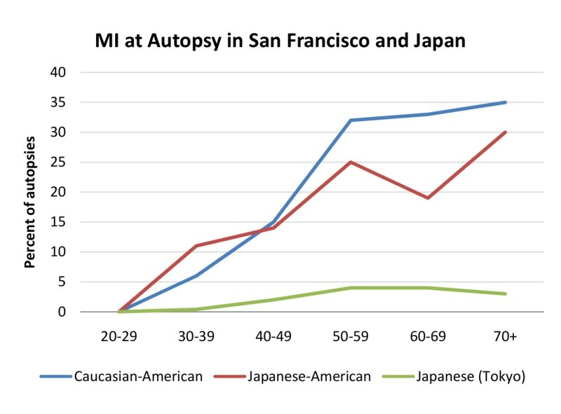 MI - SF and Japan