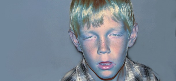 Sick Boy, by Justus Thane