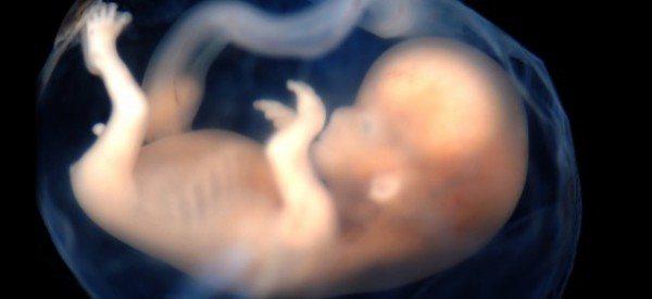 Fetuses Drugged in Attempt to Prevent Obesity