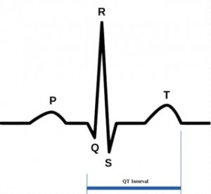 QT Interval